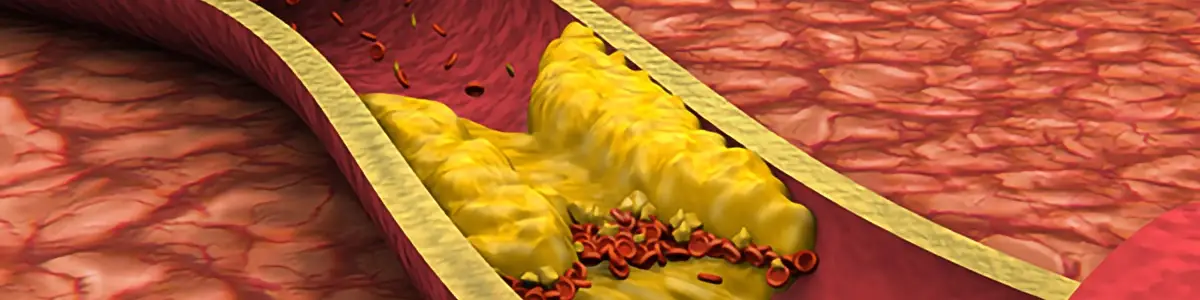Cholesterol